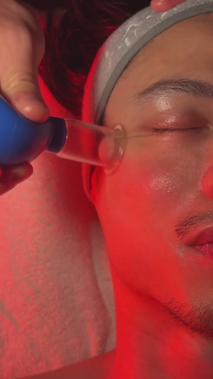 video of Face pilates treatment with facial cups on a male